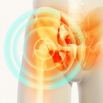 How do Orthobiologics Work for Hip Pain?