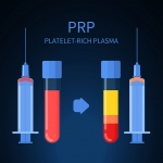 Platelet-Rich Plasma - Is this the magic juice?